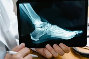 Traumatologia w Pruszkowie – diagnostyka i leczenie urazów narządu ruchu